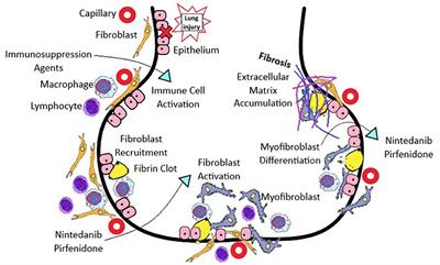 Systemic Sclerosis Associated Interstitial Lung Disease: New Directions in Disease Management